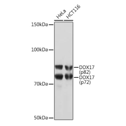 Western Blot - Anti-DDX17 Antibody [ARC1413] (A9746) - Antibodies.com