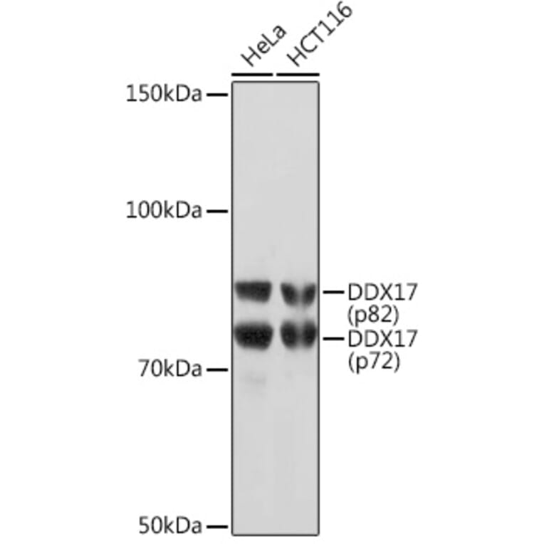 Western Blot - Anti-DDX17 Antibody [ARC1413] (A9746) - Antibodies.com