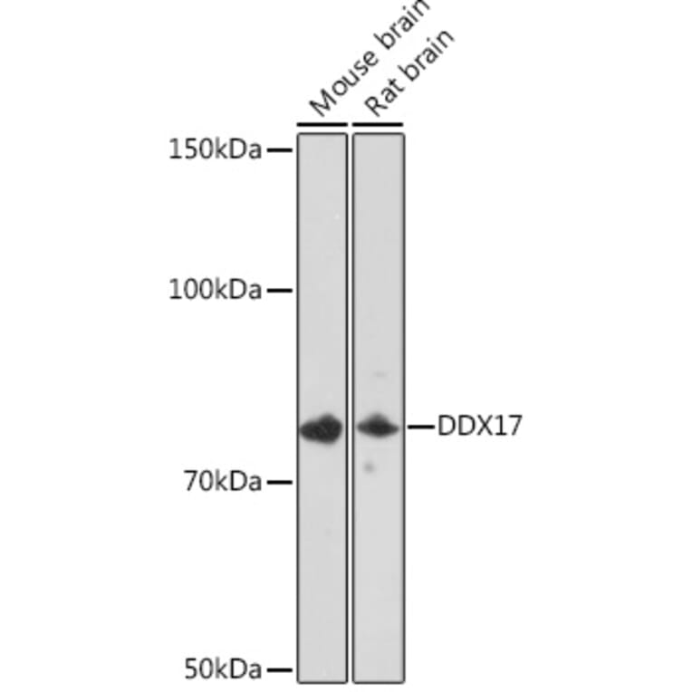 Western Blot - Anti-DDX17 Antibody [ARC1413] (A9746) - Antibodies.com