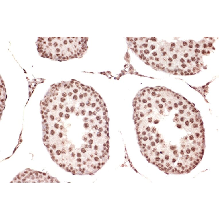Immunohistochemistry - Anti-DDX17 Antibody [ARC1413] (A9746) - Antibodies.com