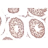 Immunohistochemistry - Anti-DDX17 Antibody [ARC1413] (A9746) - Antibodies.com