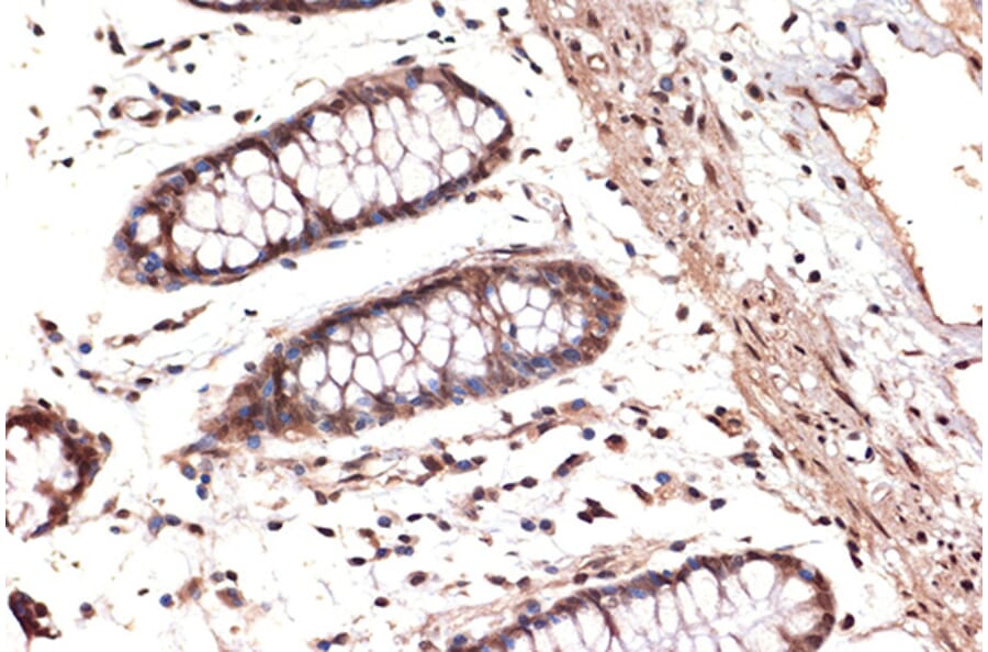 Immunohistochemistry - Anti-DDX17 Antibody [ARC1413] (A9746) - Antibodies.com