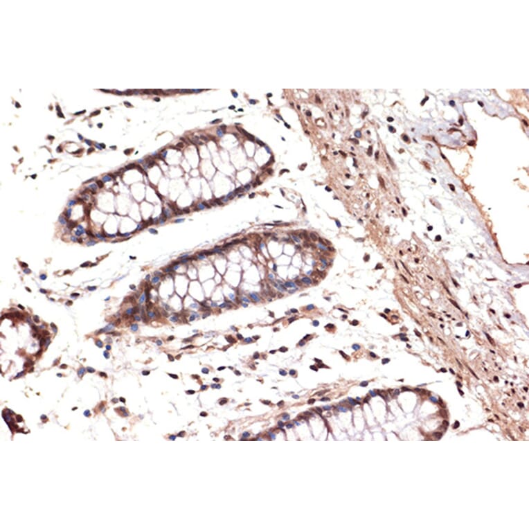 Immunohistochemistry - Anti-DDX17 Antibody [ARC1413] (A9746) - Antibodies.com