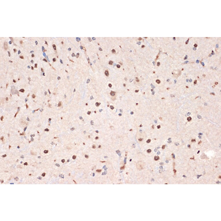 Immunohistochemistry - Anti-DDX17 Antibody [ARC1413] (A9746) - Antibodies.com