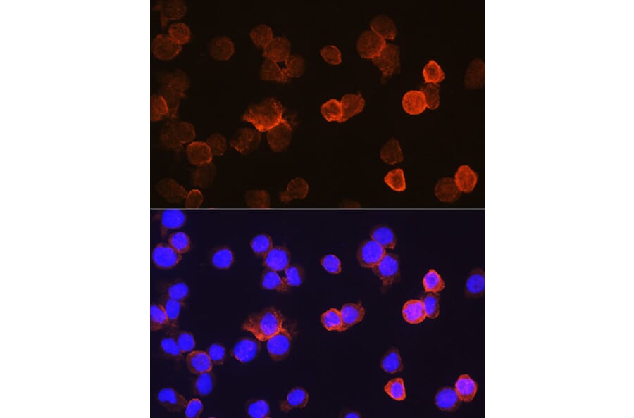 Immunofluorescence - Anti-CD14 Antibody (A9747) - Antibodies.com