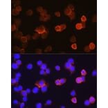 Immunofluorescence - Anti-CD14 Antibody (A9747) - Antibodies.com