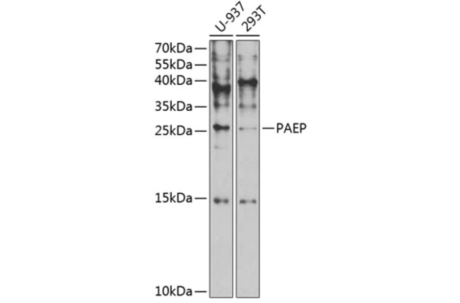 Western Blot - Anti-PAEP/Glycodelin Antibody (A9749) - Antibodies.com