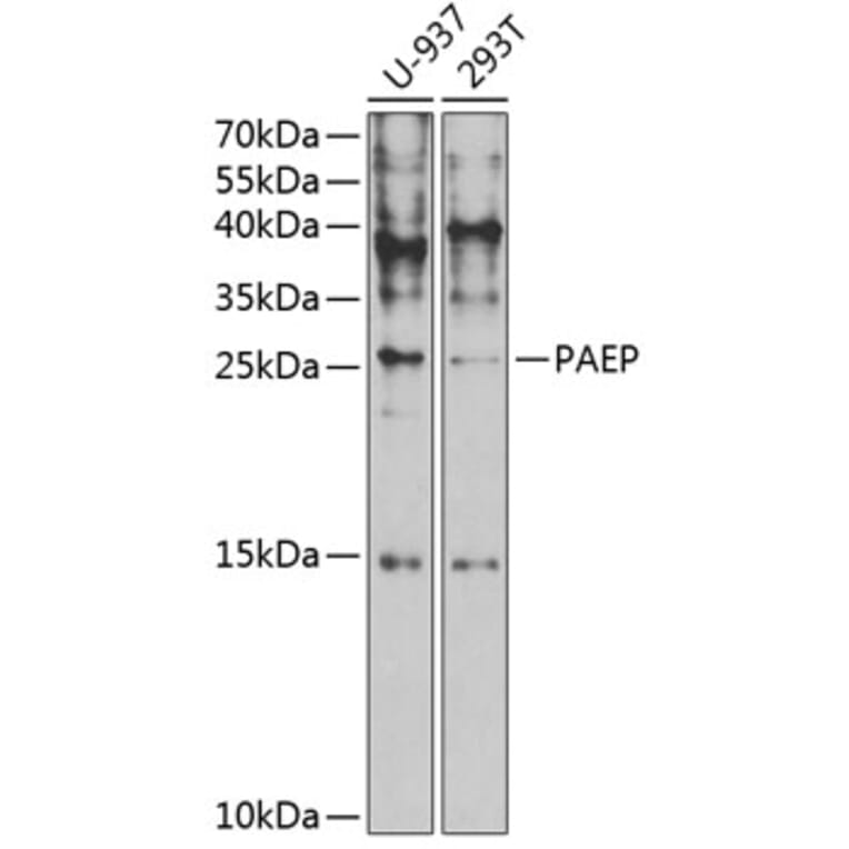 Western Blot - Anti-PAEP/Glycodelin Antibody (A9749) - Antibodies.com