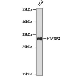 Western Blot - Anti-TIP30 Antibody (A9751) - Antibodies.com
