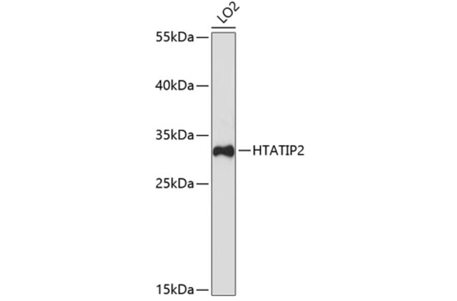 Western Blot - Anti-TIP30 Antibody (A9751) - Antibodies.com