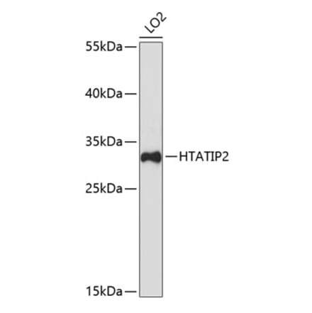 Western Blot - Anti-TIP30 Antibody (A9751) - Antibodies.com