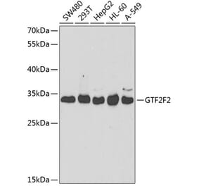 Western Blot - Anti-GTF2F2 Antibody (A9752) - Antibodies.com