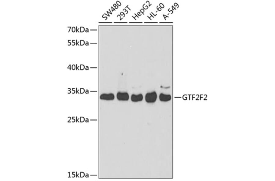 Western Blot - Anti-GTF2F2 Antibody (A9752) - Antibodies.com