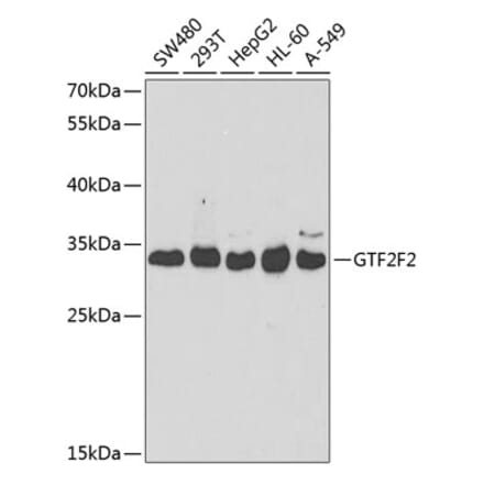 Western Blot - Anti-GTF2F2 Antibody (A9752) - Antibodies.com