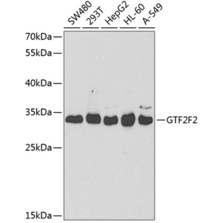 Western Blot - Anti-GTF2F2 Antibody (A9752) - Antibodies.com
