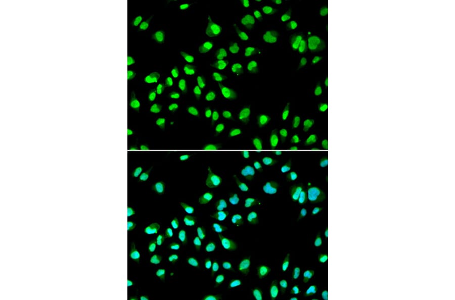 Immunofluorescence - Anti-GTF2F2 Antibody (A9752) - Antibodies.com