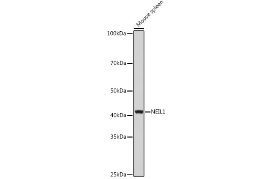 Western Blot - Anti-NEIL1 Antibody (A9753) - Antibodies.com