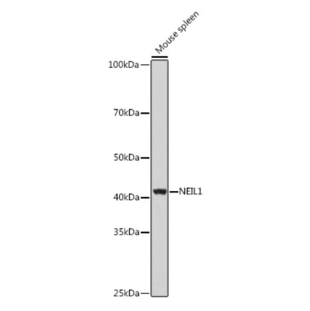 Western Blot - Anti-NEIL1 Antibody (A9753) - Antibodies.com