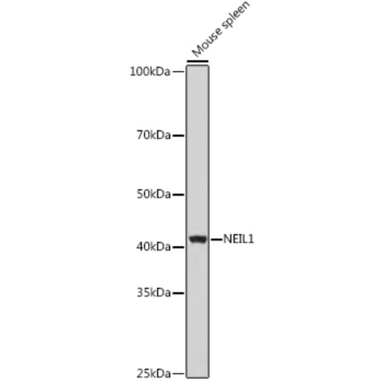 Western Blot - Anti-NEIL1 Antibody (A9753) - Antibodies.com