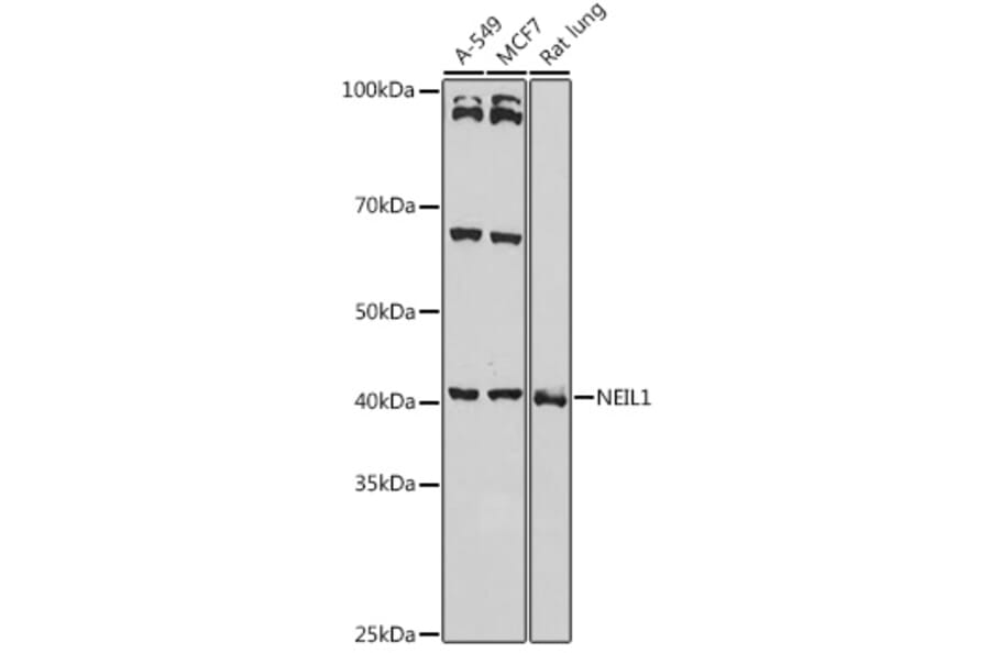 Western Blot - Anti-NEIL1 Antibody (A9753) - Antibodies.com