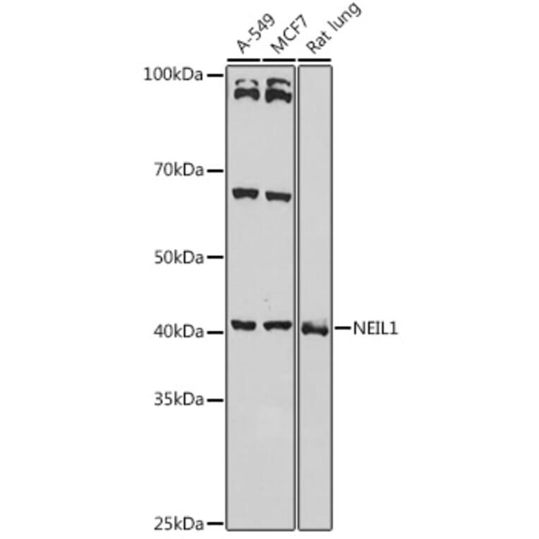 Western Blot - Anti-NEIL1 Antibody (A9753) - Antibodies.com