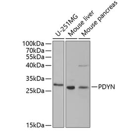 Western Blot - Anti-ProDynorphin Antibody (A9754) - Antibodies.com