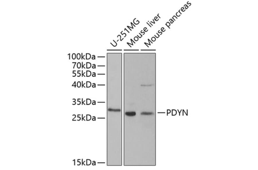 Western Blot - Anti-ProDynorphin Antibody (A9754) - Antibodies.com