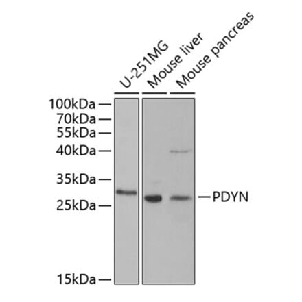 Western Blot - Anti-ProDynorphin Antibody (A9754) - Antibodies.com