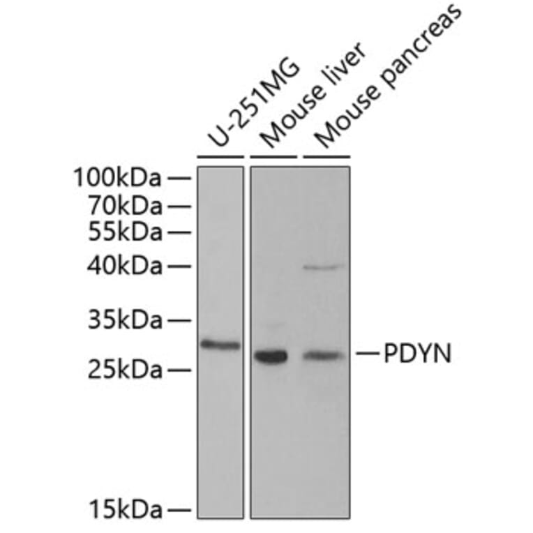 Western Blot - Anti-ProDynorphin Antibody (A9754) - Antibodies.com
