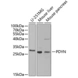 Western Blot - Anti-ProDynorphin Antibody (A9754) - Antibodies.com