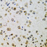 Immunohistochemistry - Anti-ProDynorphin Antibody (A9754) - Antibodies.com