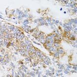 Immunohistochemistry - Anti-ProDynorphin Antibody (A9754) - Antibodies.com