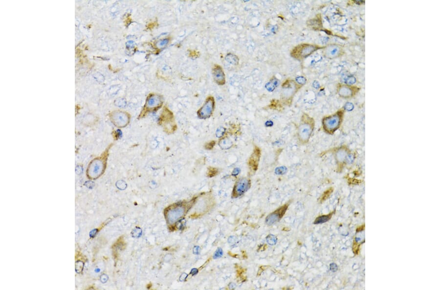 Immunohistochemistry - Anti-ProDynorphin Antibody (A9754) - Antibodies.com