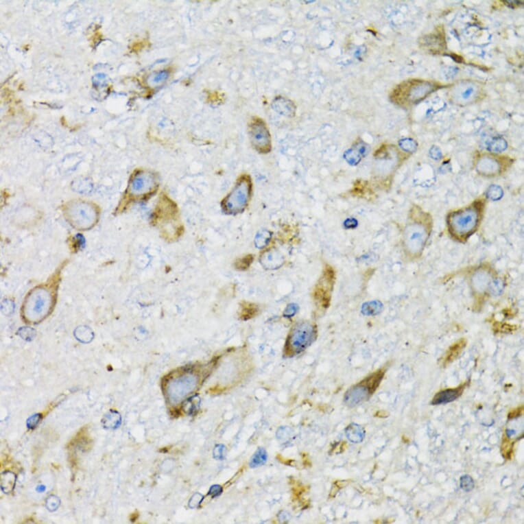 Immunohistochemistry - Anti-ProDynorphin Antibody (A9754) - Antibodies.com