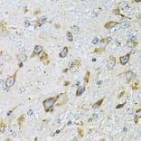 Immunohistochemistry - Anti-ProDynorphin Antibody (A9754) - Antibodies.com