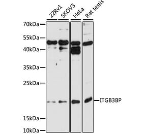 Western Blot - Anti-ITGB3BP Antibody (A9755) - Antibodies.com