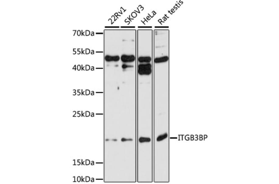 Western Blot - Anti-ITGB3BP Antibody (A9755) - Antibodies.com