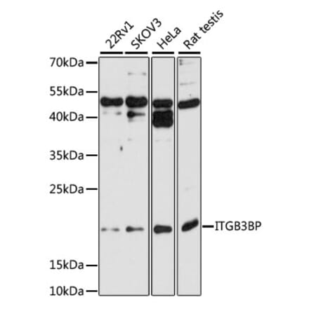 Western Blot - Anti-ITGB3BP Antibody (A9755) - Antibodies.com