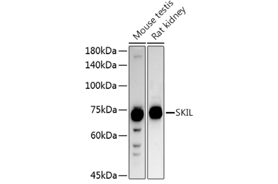 Western Blot - Anti-SnoN/SNO Antibody (A9756) - Antibodies.com