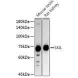 Western Blot - Anti-SnoN/SNO Antibody (A9756) - Antibodies.com