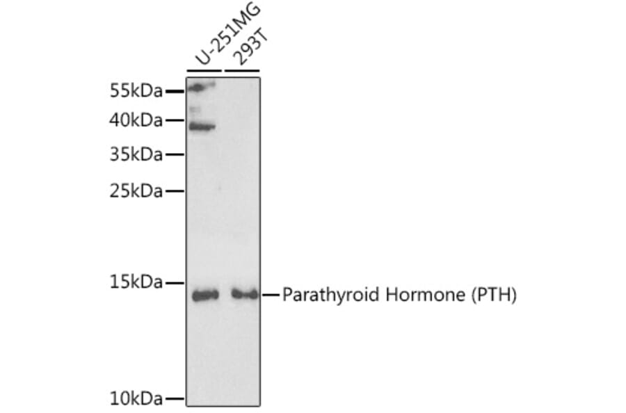 Western Blot - Anti-Parathyroid Hormone Antibody (A9757) - Antibodies.com