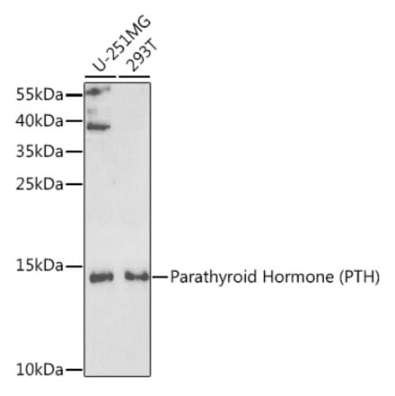 Western Blot - Anti-Parathyroid Hormone Antibody (A9757) - Antibodies.com