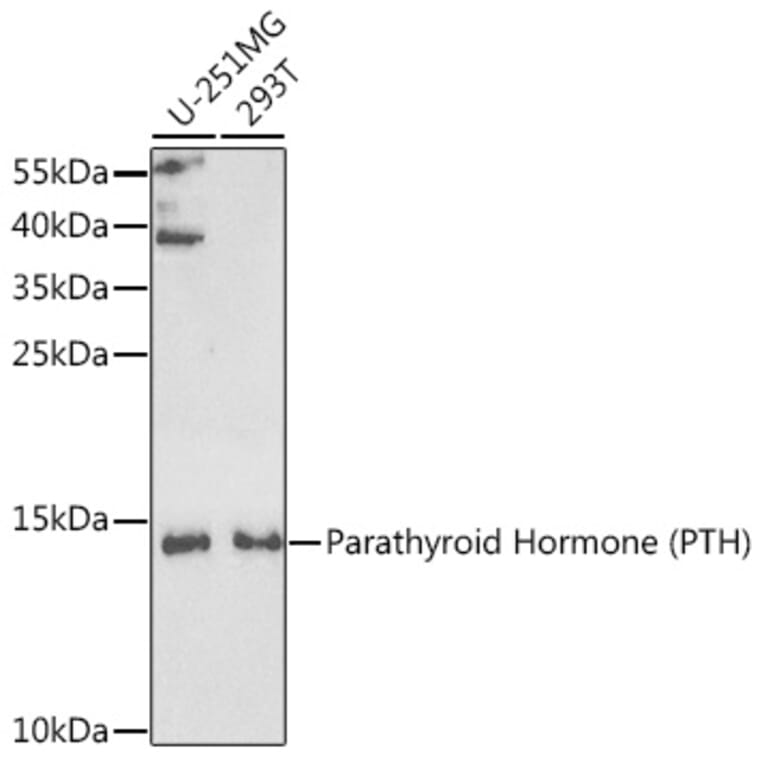 Western Blot - Anti-Parathyroid Hormone Antibody (A9757) - Antibodies.com