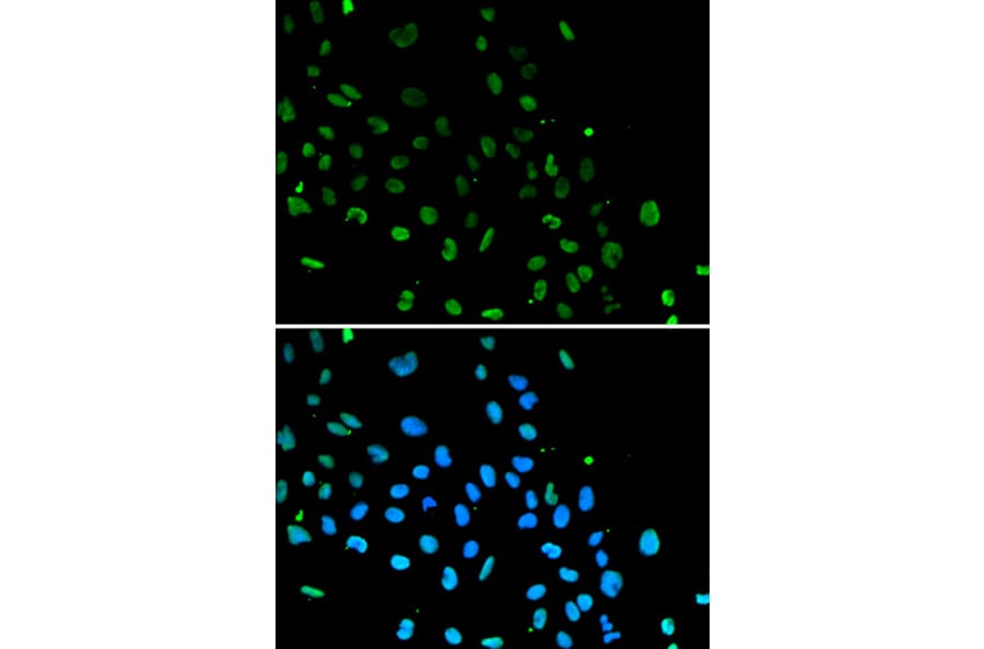 Immunofluorescence - Anti-Ku80 Antibody (A9759) - Antibodies.com