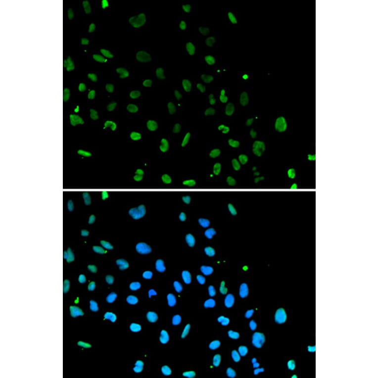 Immunofluorescence - Anti-Ku80 Antibody (A9759) - Antibodies.com