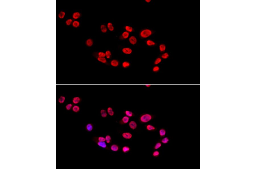 Immunofluorescence - Anti-Ku80 Antibody (A9759) - Antibodies.com