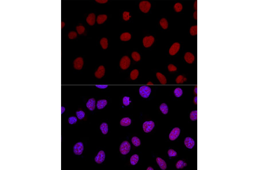 Immunofluorescence - Anti-Ku80 Antibody (A9759) - Antibodies.com
