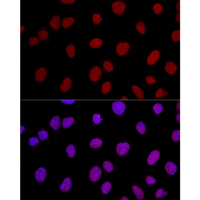 Immunofluorescence - Anti-Ku80 Antibody (A9759) - Antibodies.com