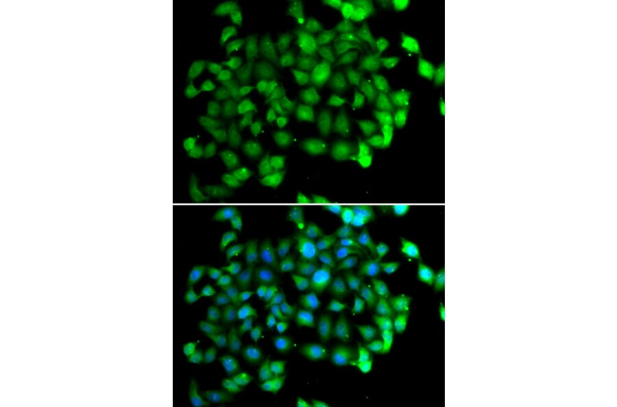 Immunofluorescence - Anti-APOBEC3C Antibody (A5877) - Antibodies.com