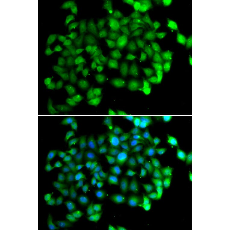 Immunofluorescence - Anti-APOBEC3C Antibody (A5877) - Antibodies.com